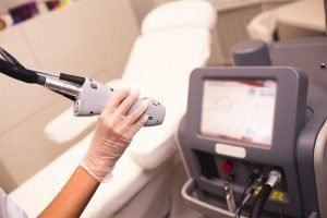 Maquina-moderna-para-la-aplicación-de-la-depilación-laser